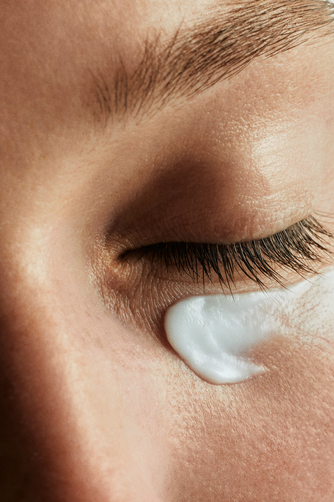 Cernes et poches sous les yeux : les actifs les plus efficaces
